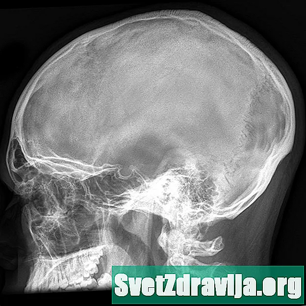 Craniu X-Ray