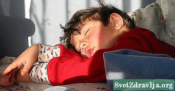 Søvnapnø hos børn: Hvad du behøver at vide