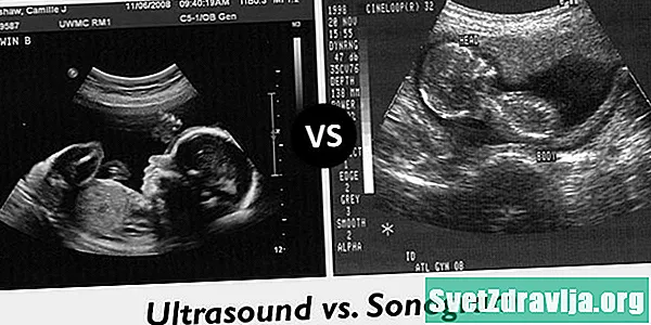 Sonogram vs. Ultraschall