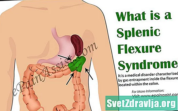 Splenic Flexure sindromi