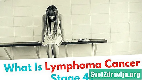 Trin 4 Lymfom: Fakta, typer, symptomer og behandling