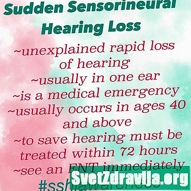 Nenadna senzorineuralna izguba sluha (SSHL) - Zdravje