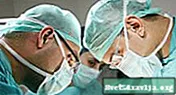 کرون کی بیماری کے لئے سرجری: کولیکٹومیز
