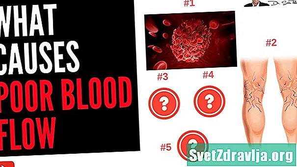 Prastos kraujotakos simptomai ir priežastys