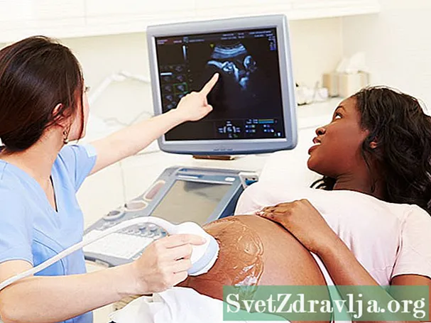 怀孕期间的检查：腹部超声