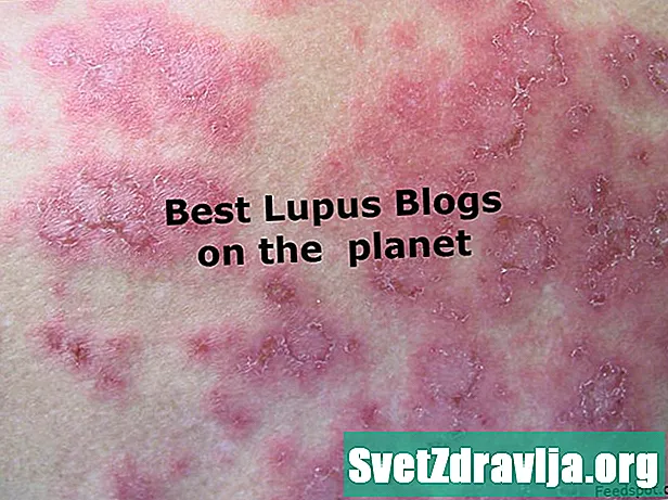 Nejlepší blogy Lupus roku 2020 - Zdraví