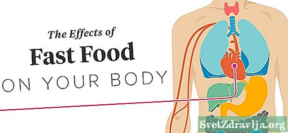 Efektet e ushqimit të shpejtë në trup