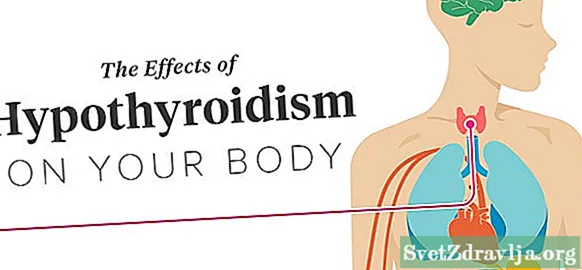 Virkningerne af hypotyreose på kroppen