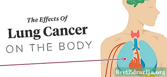 Efekti raka pluća na tijelo