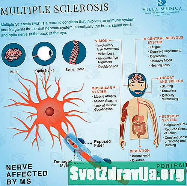 Die Möglichkeit der Prävention von Multipler Sklerose - Gesundheit