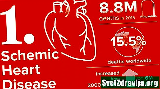 10 sëmundjet më vdekjeprurëse - Shëndetësor