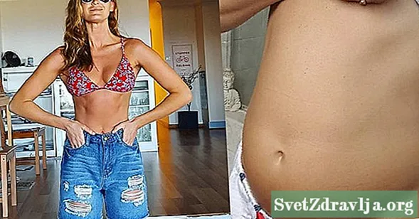 Tento model Instagramu se stal skutečným o jejím IBS - a o tom, jak to řídí