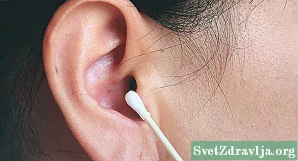Tips Membersihkan Telinga Anda Dengan Aman