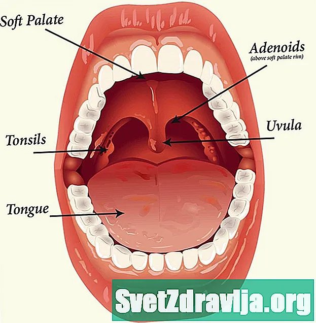 Gambaran Keseluruhan Tonsil dan Adenoids