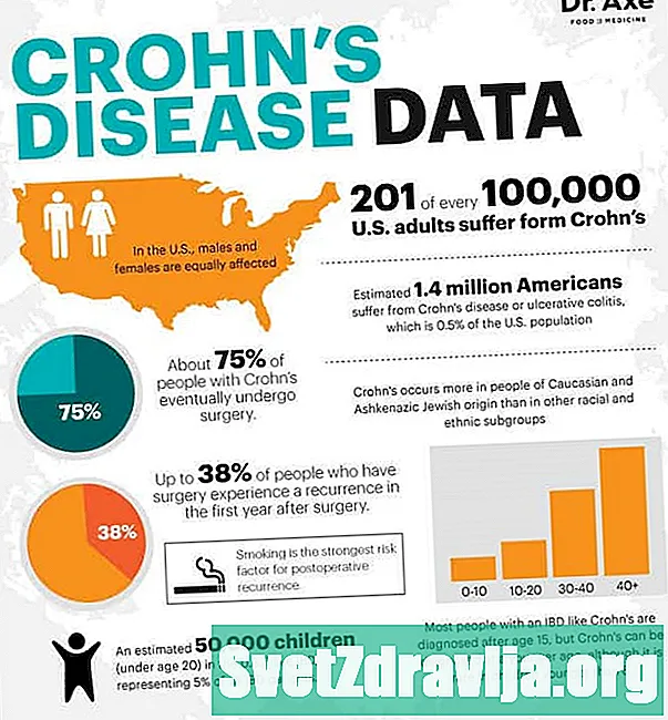 Behandling af børn, der har Crohns sygdom - Sundhed