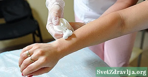 Liječenje opekotina na koži od depilacije