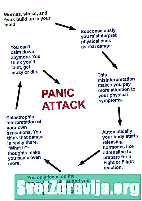 Trajtimi i çrregullimit të sulmit panik - Shëndetësor