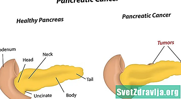 Opções de tratamento para insuficiência pancreática exócrina - Saúde