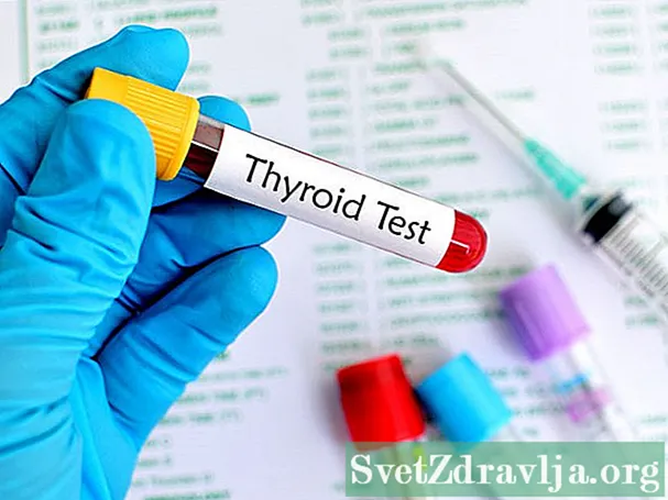 TSH (Thyroid Inokurudzira Hormone) Bvunzo - Utano