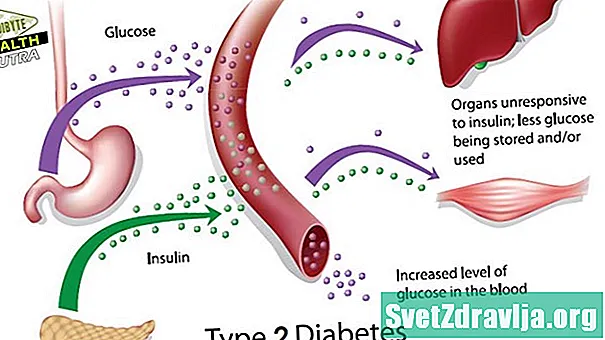 Diabeti i tipit 2: A është një sëmundje autoimune? - Shëndetësor