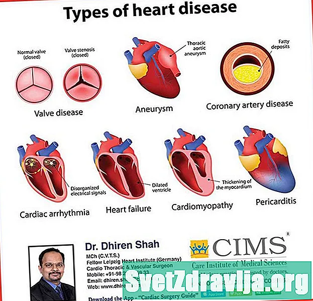 A szívroham típusai: Mit kell tudni - Egészség