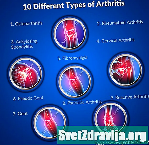 5 artriidi tüüpi, mis mõjutavad õla - Tervis