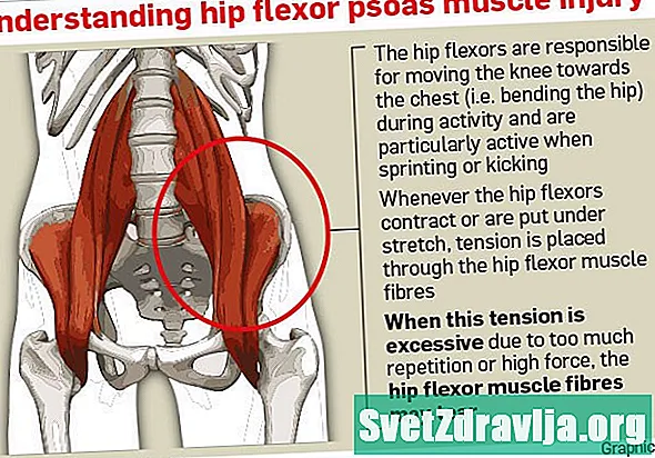 Hip Flexor deformacijos supratimas