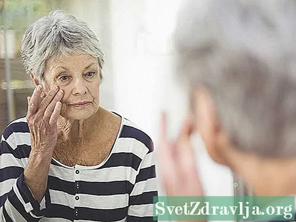 Κατανόηση της υπερπλασίας του Sebaceous