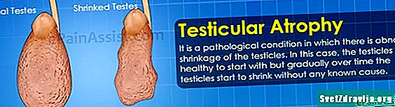 Pochopenie testikulárnej atrofie - Zdravie