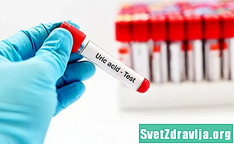 Testul de acid uric (analiza sângelui)