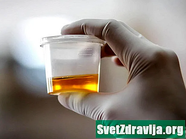 Teste de ácido úrico (análise de urina)