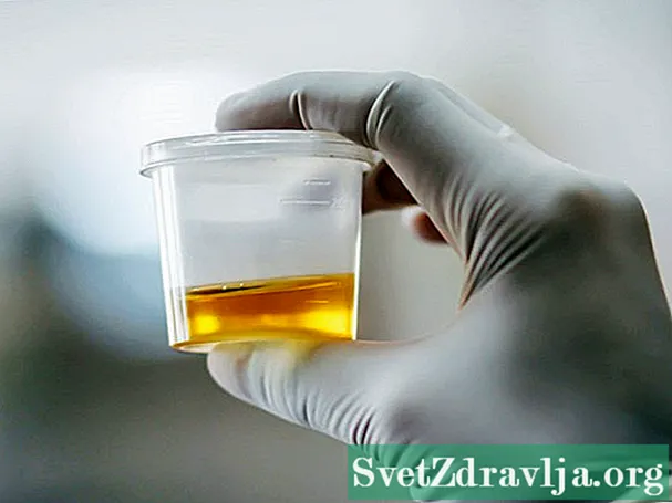 Test tal-Livell tal-urina hCG