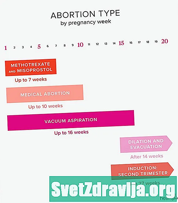 Was sind die verschiedenen Arten der Abtreibung?