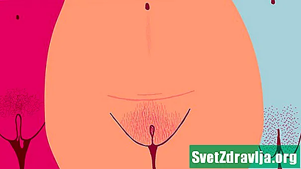 Ce cauzează o zonă vaginală „grasă” și este normală?