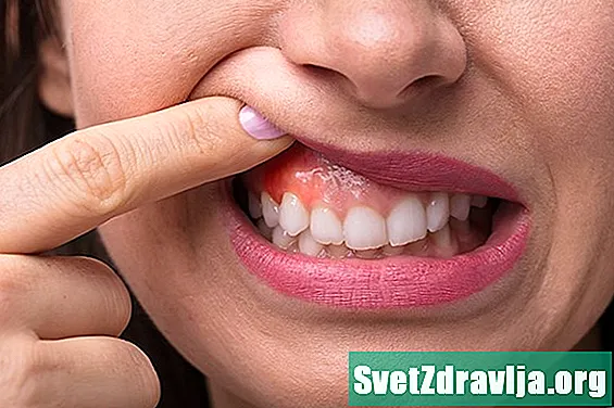 O que causa uma gengiva inchada em torno de um dente?