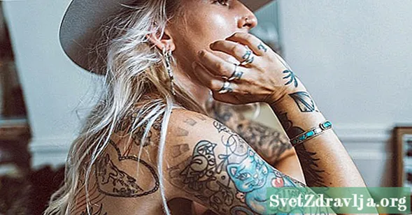 Cosa causa un'eruzione cutanea da tatuaggio e come viene trattata?