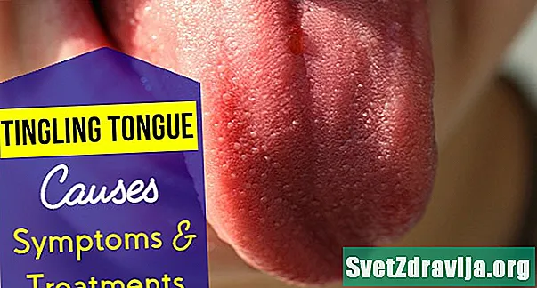 Wat verursaacht eng Tingling Tongue?