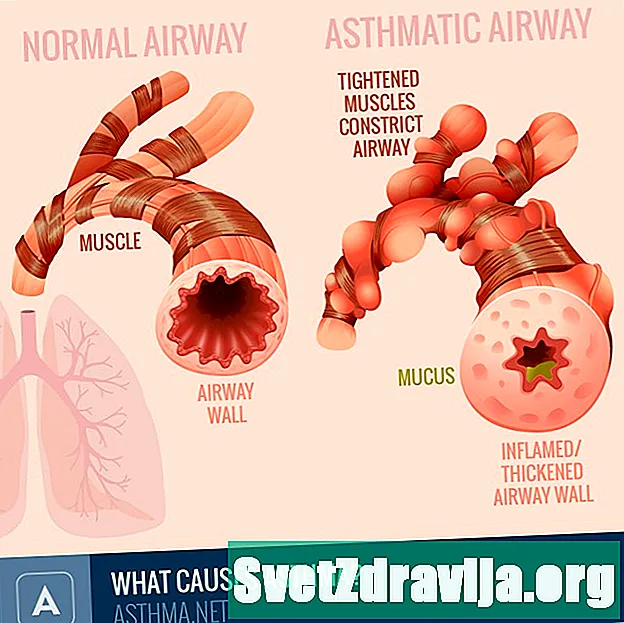 Що викликає астму?