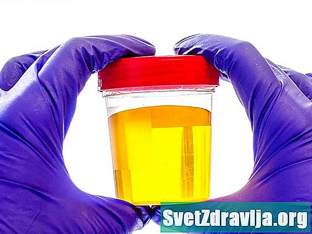 Cfarë shkakton urinën e ndritshme-të verdhë dhe ndryshimet e tjera të ngjyrës? - Shëndetësor