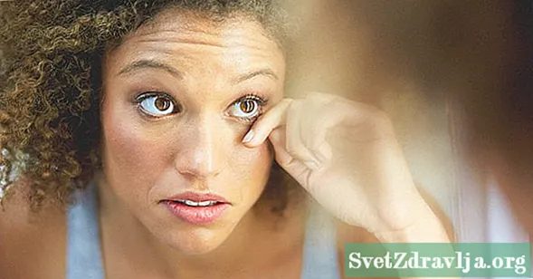 Vad orsakar mörka ögonlock och hur behandlas de? - Wellness