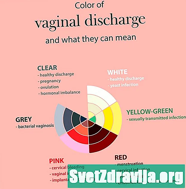 Cfarë e shkakton shkarkimin vaginal gri? - Shëndetësor