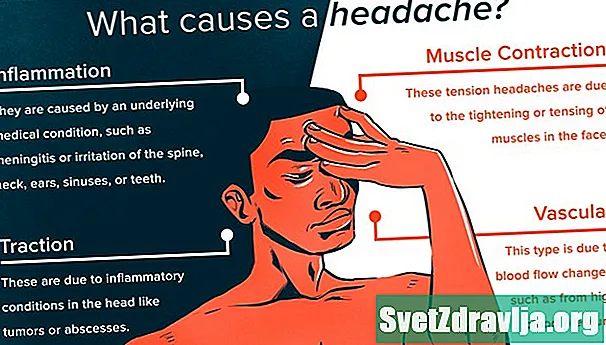 Mis põhjustab peavalu? Identifitseerimise ja ravi näpunäited