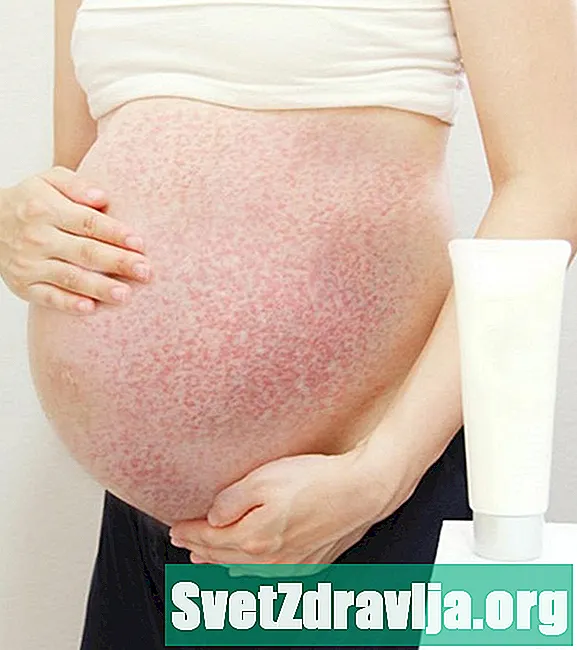 Что вызывает сыпь во время беременности и как их лечить