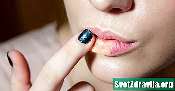 Quelles sont les causes des lèvres fendues?