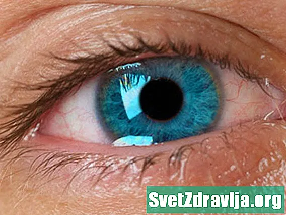 Hva er årsaken til vanning av øynene (Epiphora)?