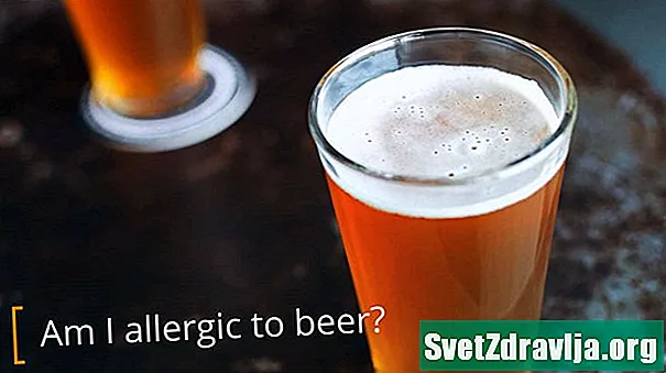 맥주 알레르기가 있다는 것은 무엇을 의미합니까?