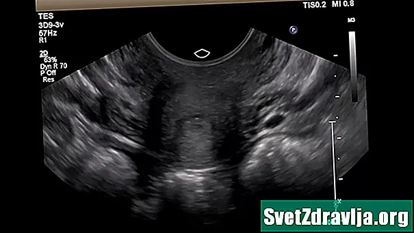 O que é um ultrassom transvaginal?