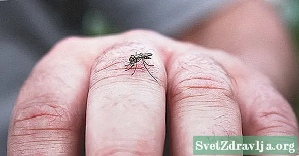 Mis on Zika lööve?