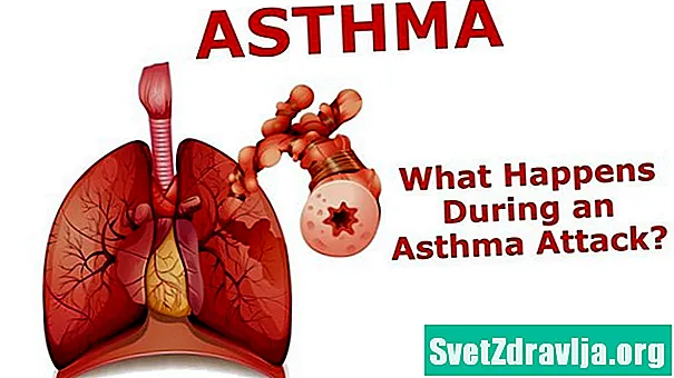 O que é um ataque de asma?