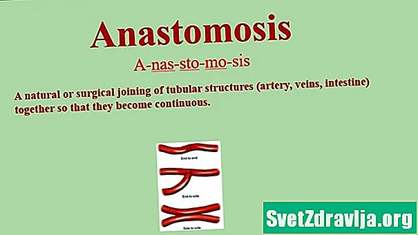Kaj je anastomoza?
